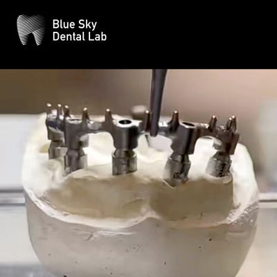 Αγορά Αφαίρετη προσθετική Ti Bar Dental Titanium Bar With Nail online manufacture