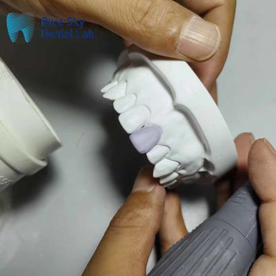 0.3mm Thin Glass Ceramic Veneer Implants Ελαφριά θήκη φινέρας