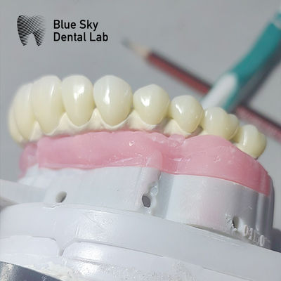Καθαρό τιτάνιο Malo Implant Bridge Παγκόσμιο μεταλλικό πλαίσιο Malo Bridge