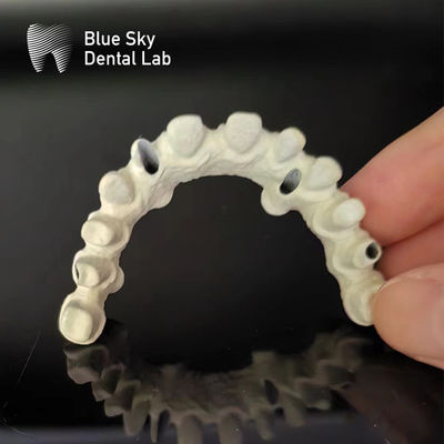 Τιτανίου Frame Malo Bridge Δοντιατρική Custom Malo Implant Bridge