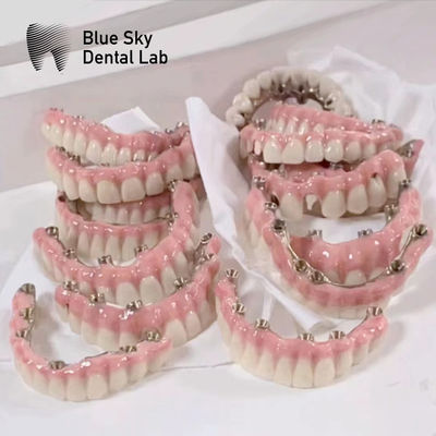 Κουτί εμφυτευμάτων Blue Sky με γέφυρα με πλαίσια Malo Pure Titanium